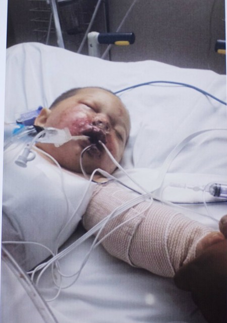 Bou-Bou - Baby Injured By Grenade