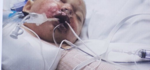 Bou-Bou - Baby Injured By Grenade