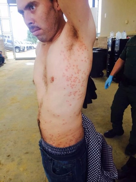 Illegal Immigration Diseases - Photo from Congressman Henry Cuellar
