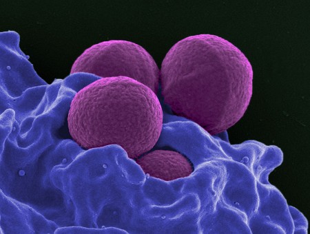 Superbugs - Public Domain