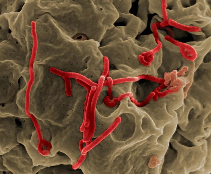 Ebola Virus - Photo by NIAID