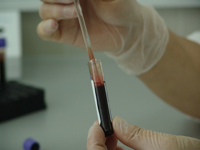 Blood Sample - Public Domain