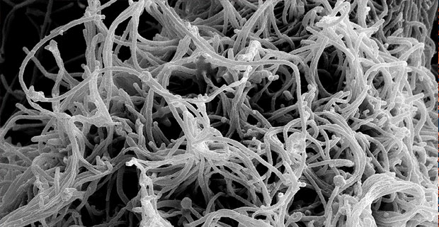 Ebola Up Close - Photo by NIAID