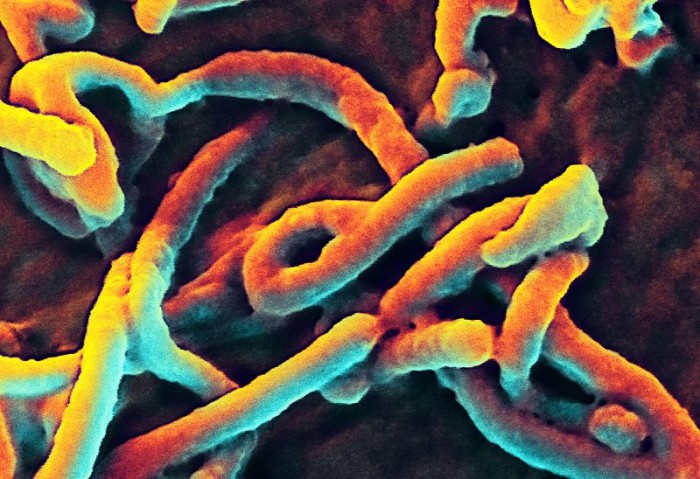 Ebola - Photo by NIAID